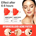 Hydrocolloid Pimple Patch Kit 72 Patches